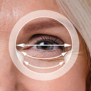 MULTIFOCAL PROGRESIVO AMPLIO 180 PROver2