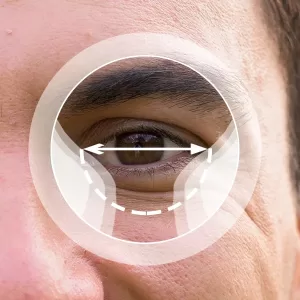 MULTIFOCAL PROGRESIVO B&Aacute;SICO